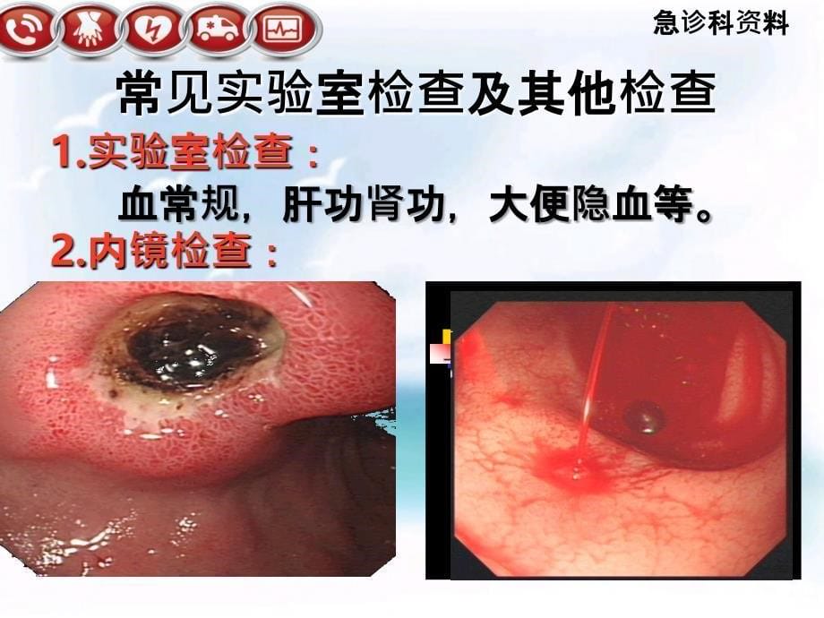 上消化道出血健康宣教PPT课件_第5页