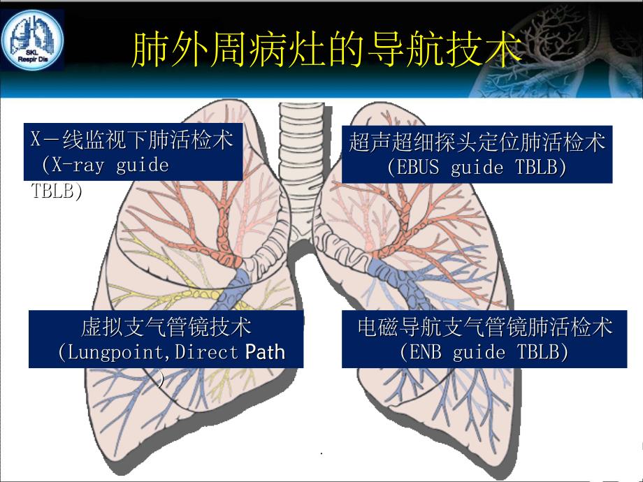 电磁导航支气管镜技术在介入肺脏病的应用ppt课件_第2页