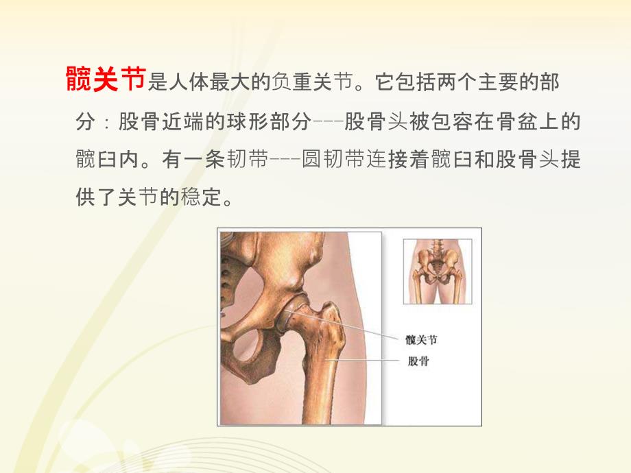 髋关节置换围手术期护理43075PPT课件_第2页