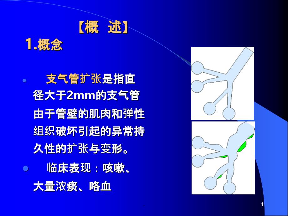 体位引流纤维支气管镜吸痰PPT课件_第4页