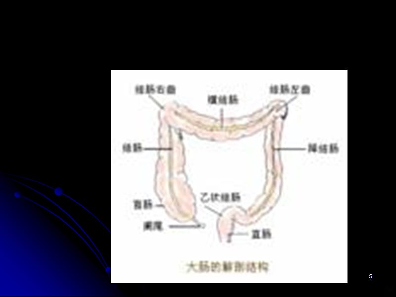 排便异常病因及治疗护理PPT课件_第5页