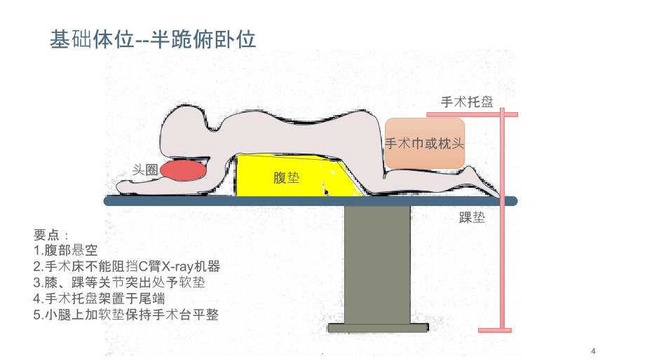 经皮内镜技术的体位与麻醉方式PPT课件_第4页
