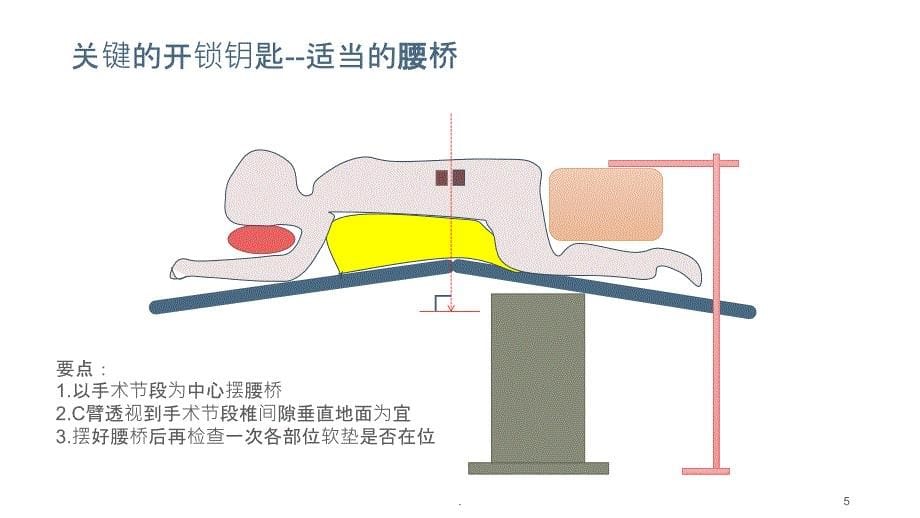 经皮内镜技术的体位与麻醉方式PPT课件_第5页