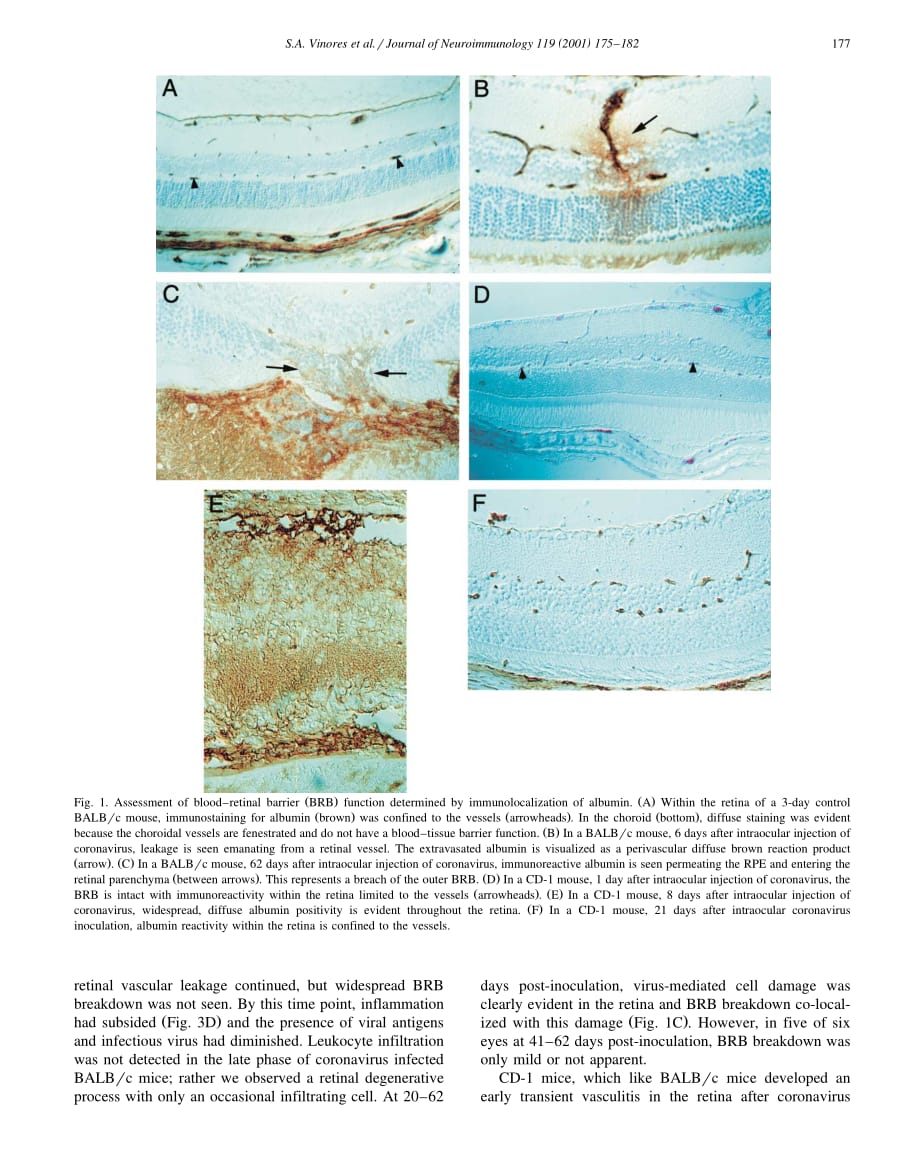 2001 Blood_retinal barrier breakdown in experimental coronavirus retinopathy_ association with viral antigen, inflammati_第3页