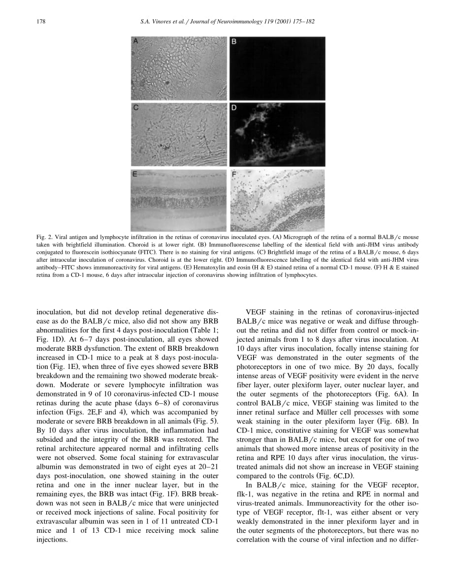 2001 Blood_retinal barrier breakdown in experimental coronavirus retinopathy_ association with viral antigen, inflammati_第4页