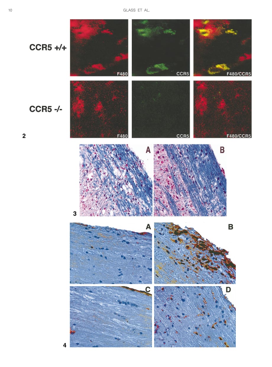 2001 Reduced Macrophage Infiltration and Demyelination in Mice Lacking the Chemokine Receptor CCR5 Following Infection w_第3页