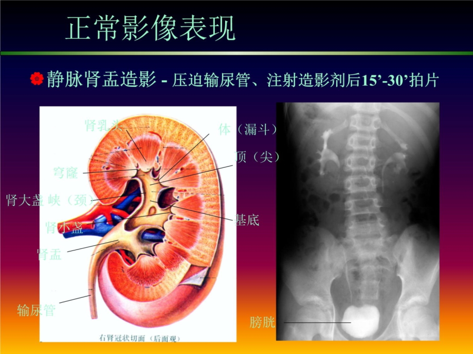 泌尿影像课件知识课件_第4页