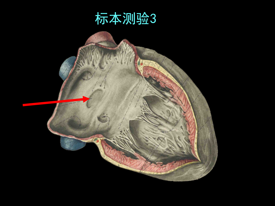 【课件-正常人体形态学实验】_脉管学标本测验_第3页