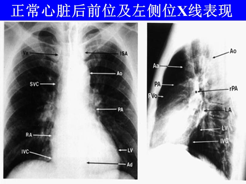 心与大血管系统影像诊断学知识分享_第5页