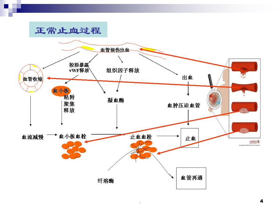 常用出凝血指标的临床意义PPT课件_第4页