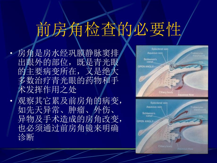 前房角镜检查法及其在眼科的应用资料讲解_第3页