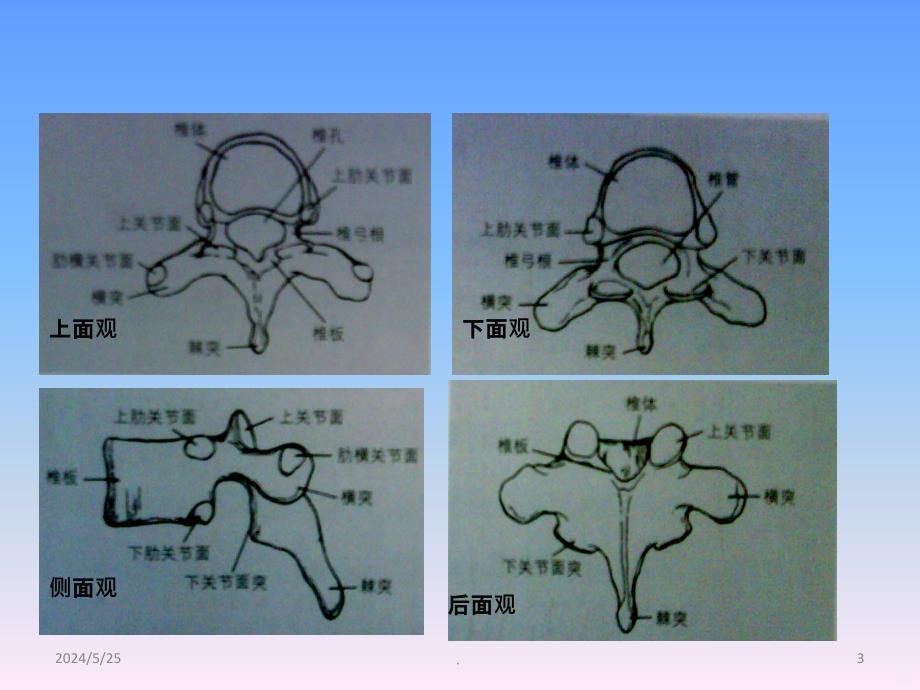 胸椎椎弓根解剖和临床PPT课件_第3页