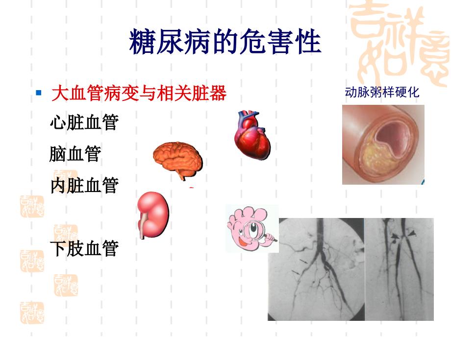 糖尿病综合围手术教学材料_第2页