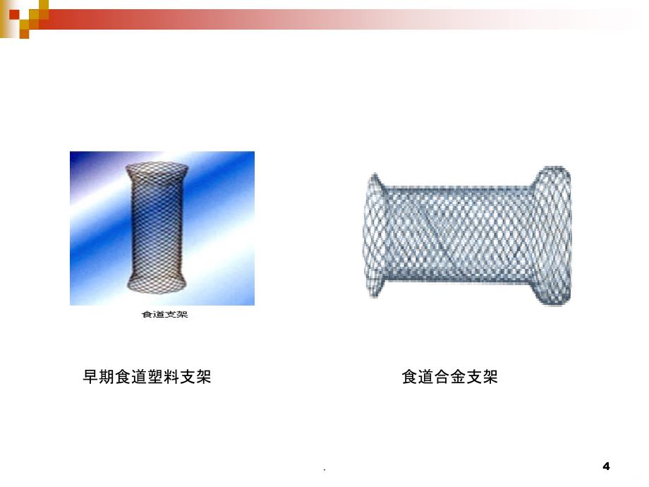 食道支架PPT课件_第4页