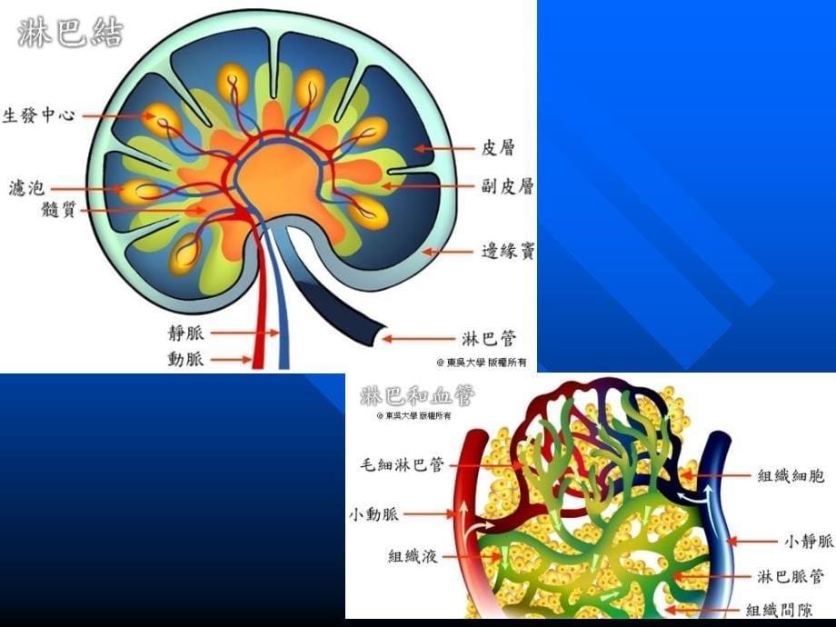 颈部淋巴结转移ct表现及鉴别诊断no1讲义资料_第5页