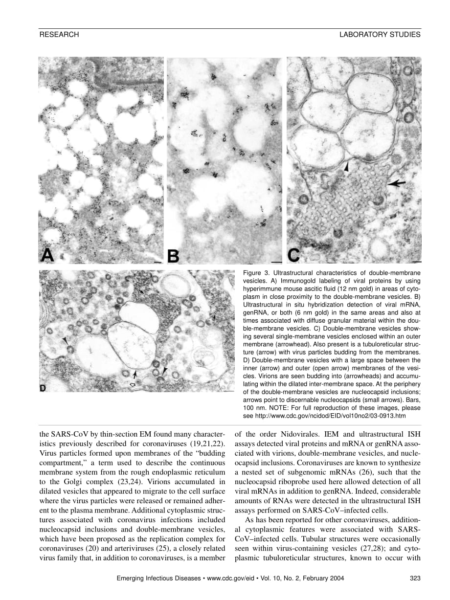 2004 Ultrastructural Characterization of SARS Coronavirus_第4页