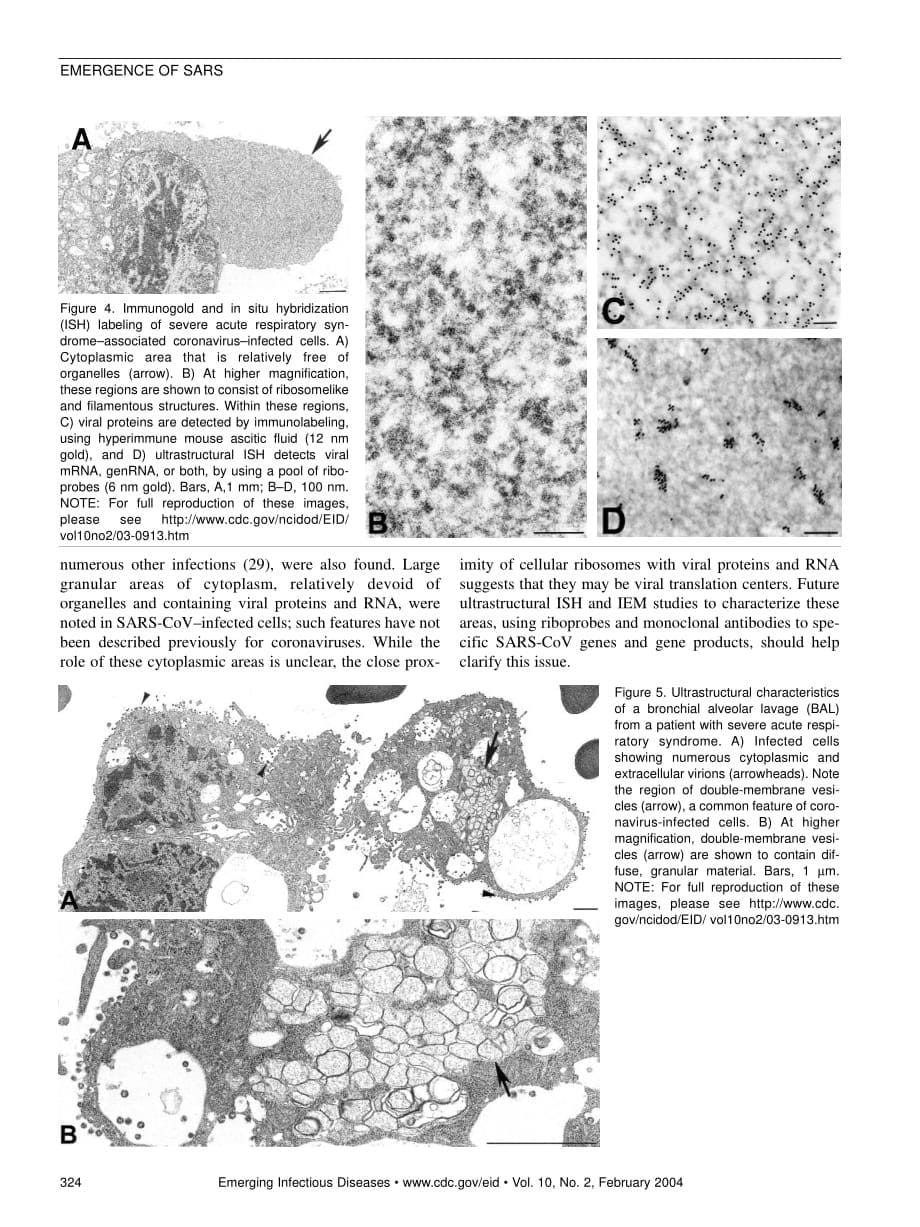 2004 Ultrastructural Characterization of SARS Coronavirus_第5页