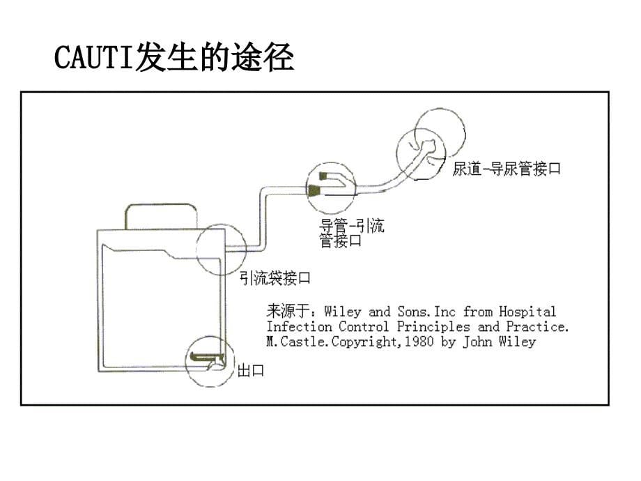 留置导尿常见问题与对策_第5页