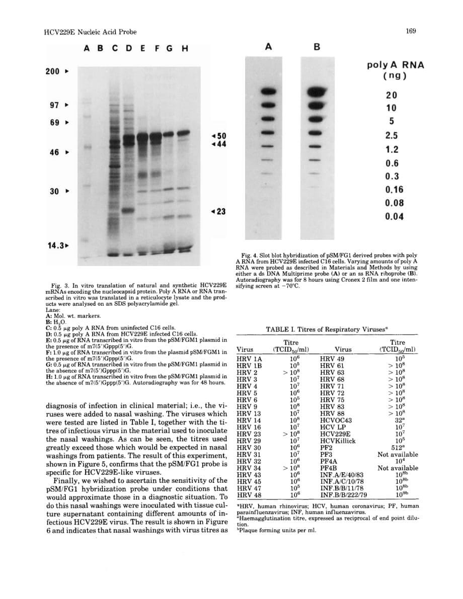 1990 Characterization of a nucleic acid probe for the diagnosis of human coronavirus 229E infections_第5页