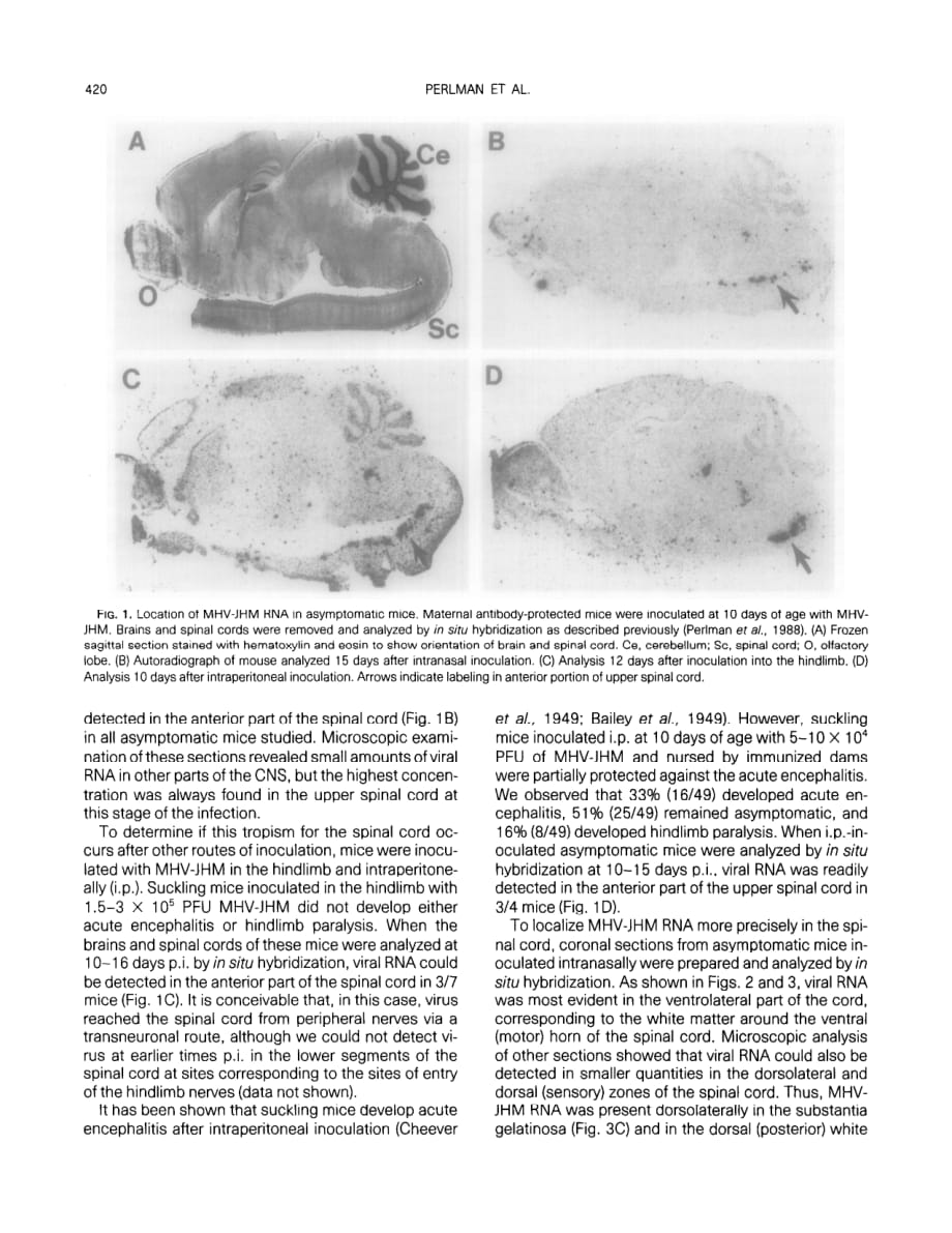 1990 Identification of the spinal cord as a major site of persistence during during chronic infection with a murine coro_第3页