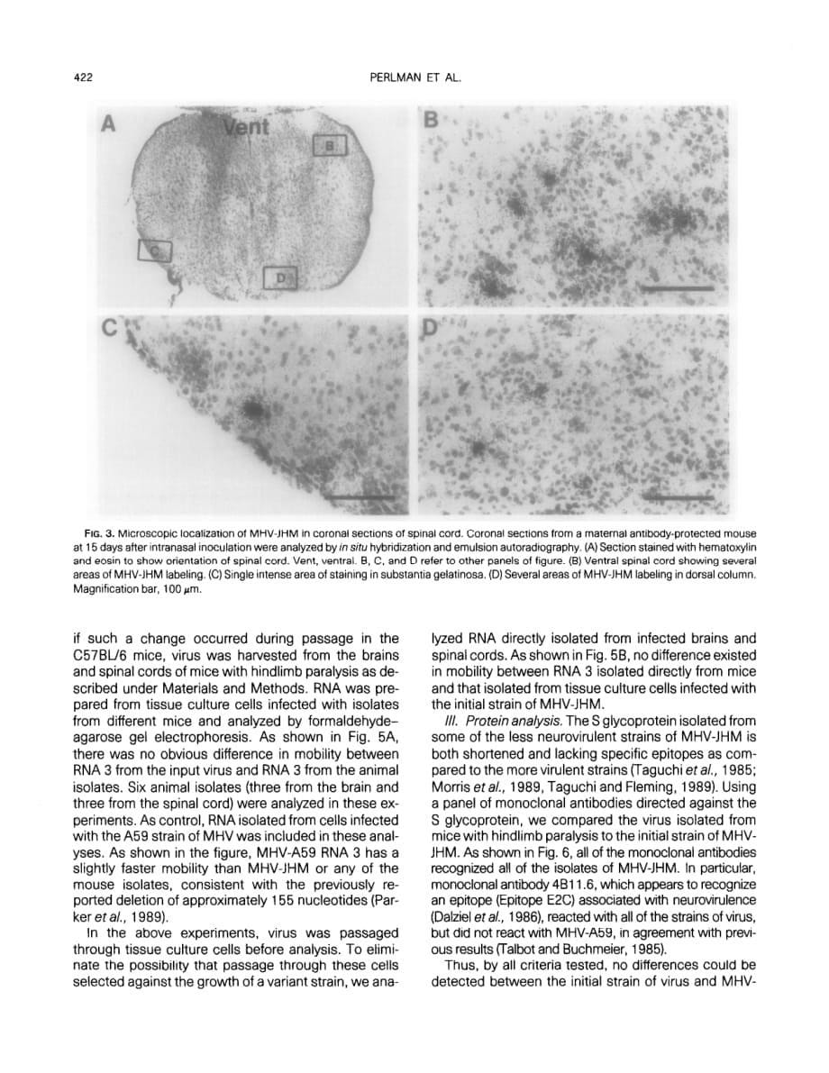 1990 Identification of the spinal cord as a major site of persistence during during chronic infection with a murine coro_第5页