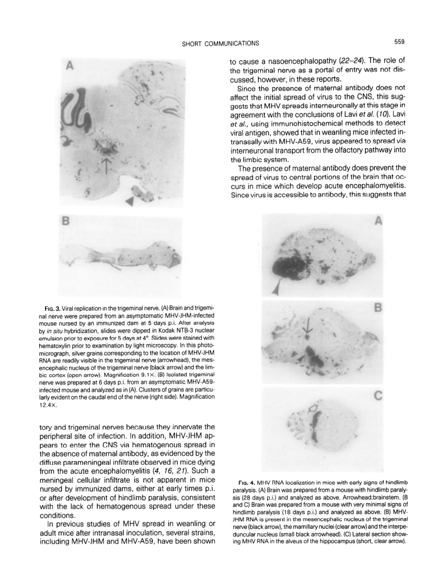 1989 Spread of a neurotropic murine coronavirus into the CNS via the trigeminal and olfactory nerves_第4页