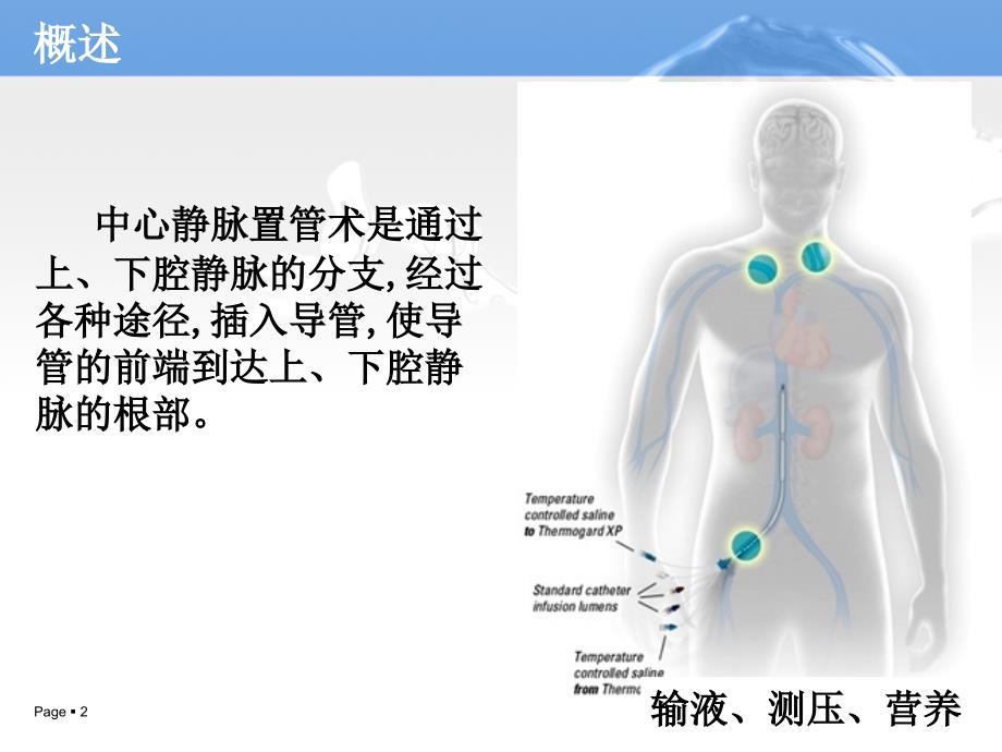 中心静脉置管术的护理(1).ppt_第2页