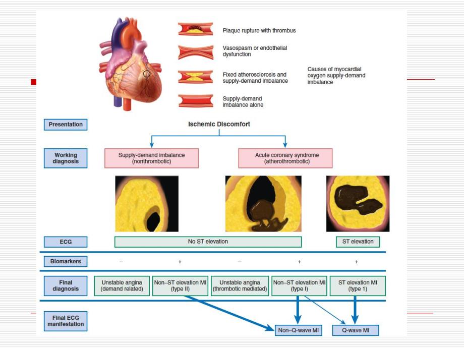 【北京医院-心内科学习】_4-2冠心病-急性心肌梗塞ACS_20200425234131_第4页