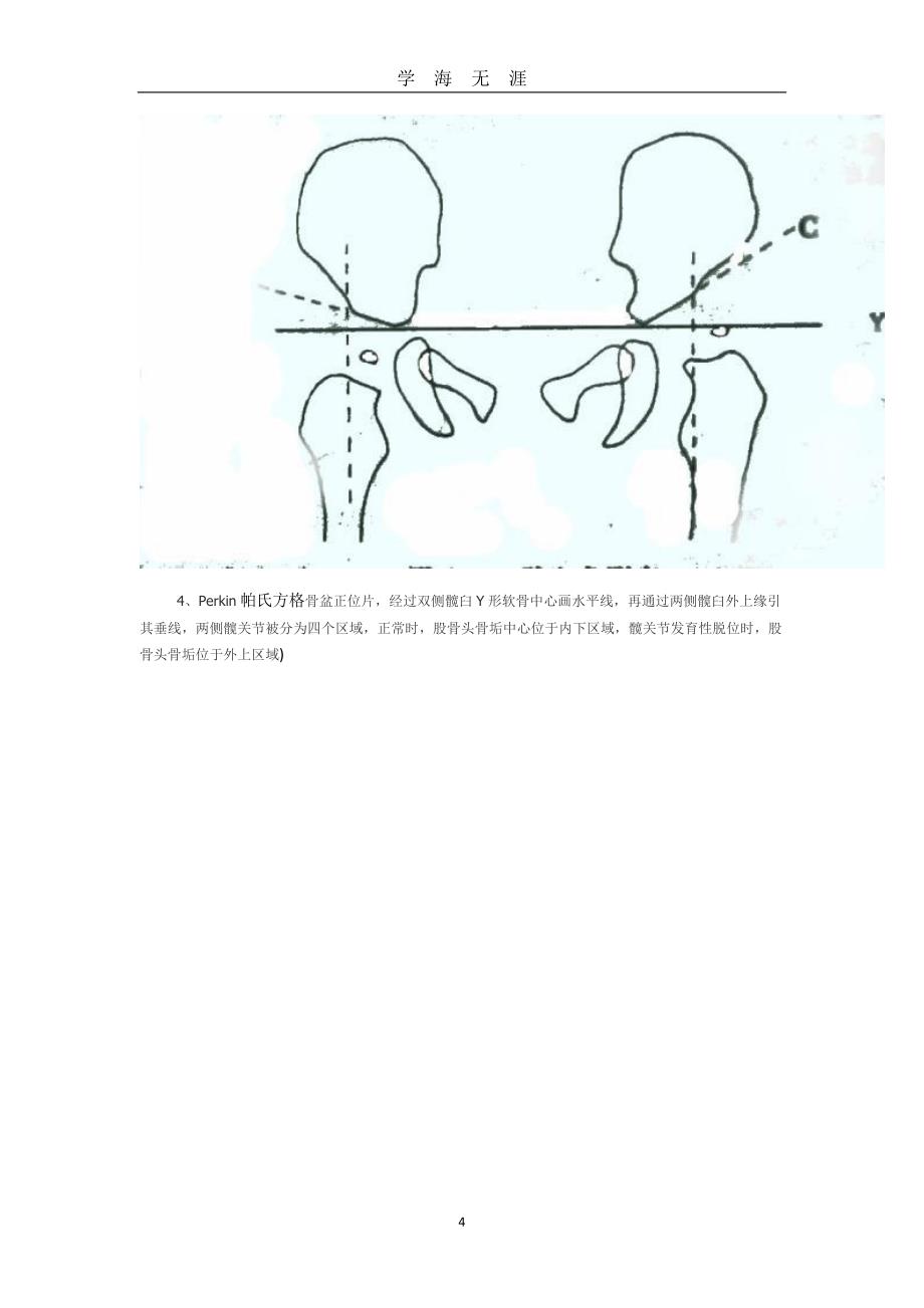 （2020年7月整理）髋角线测量.doc_第4页