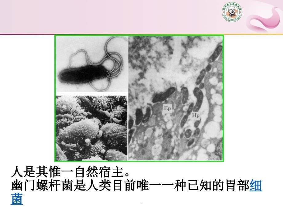 正确认识幽门螺杆菌感染pppt课件_第5页