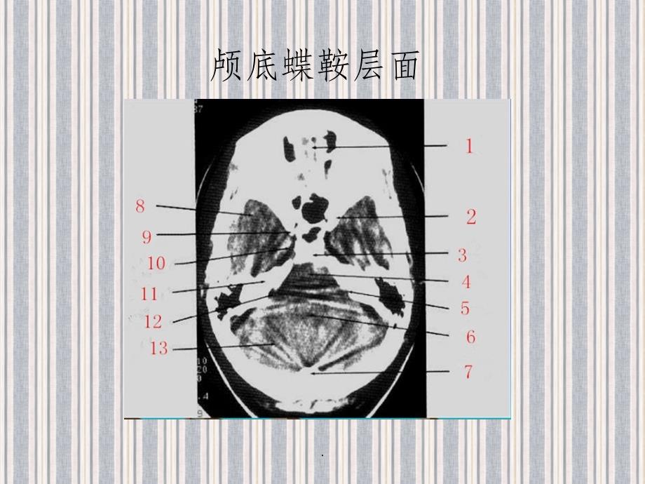 CT断层解剖ppt课件_第3页