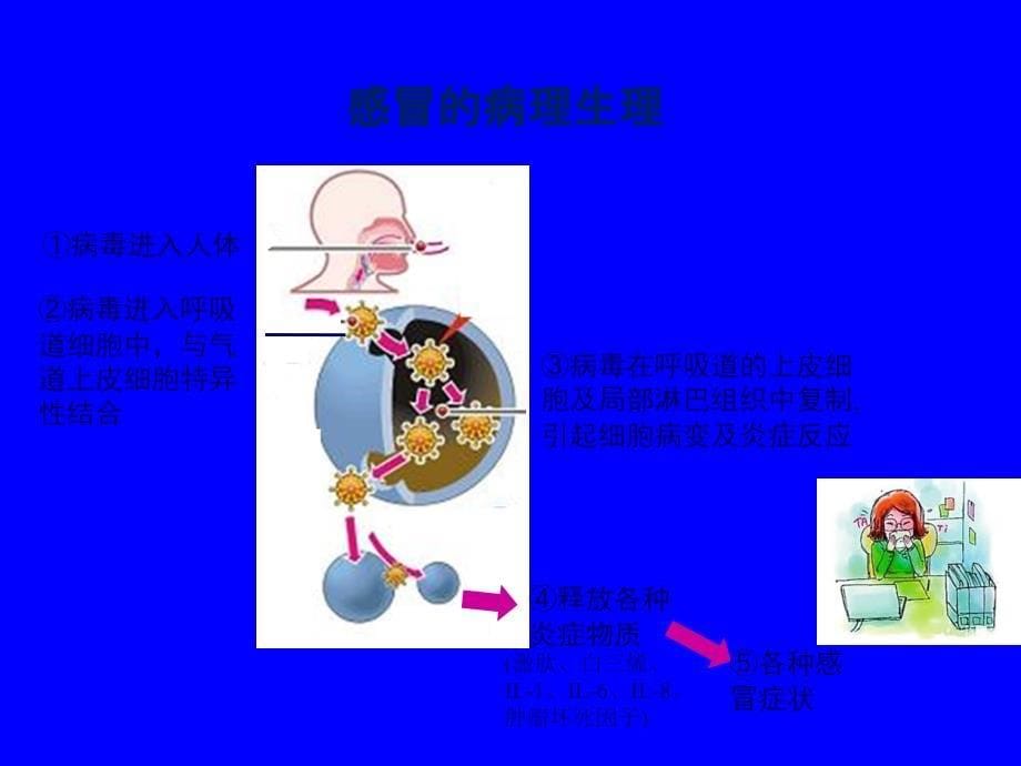 急性上呼吸道感染的诊断和治疗(标准)22164_第5页