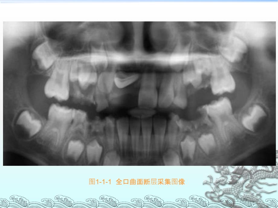 牙科三维CT(CBCT)临床应用研究_第4页