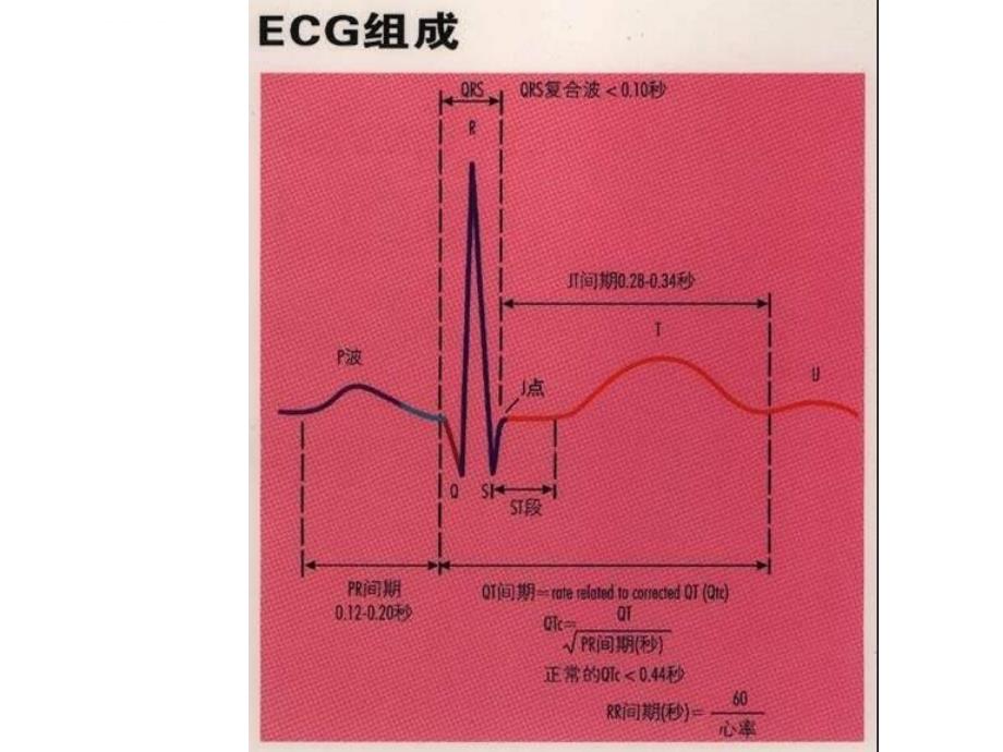 《看识心电图》ppt课件_第2页