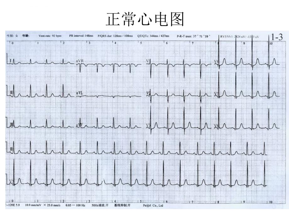 《看识心电图》ppt课件_第4页