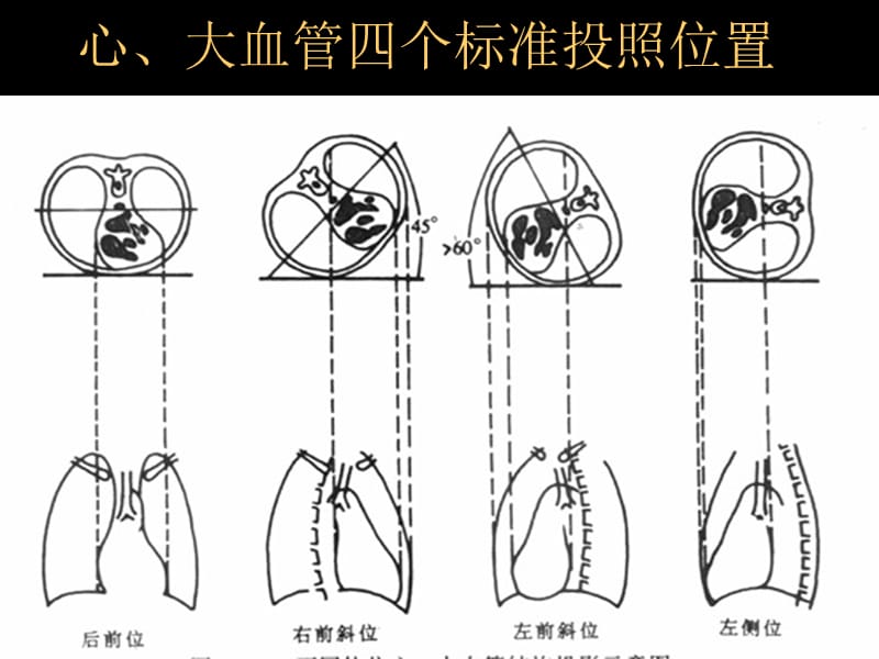 {企业管理诊断}心与大血管系统影像诊断学临床医学本科用PPT66_第4页