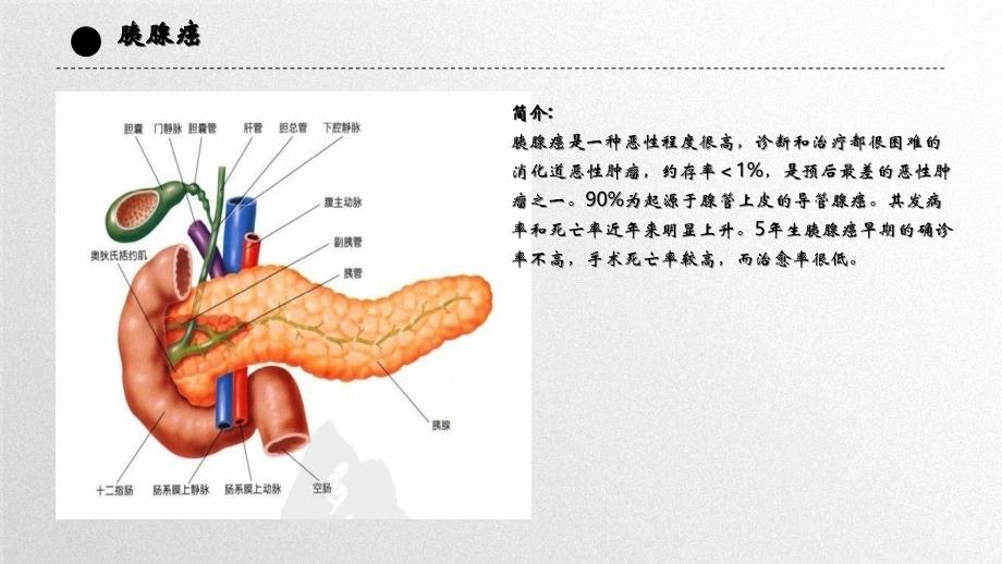 胰腺癌护理查房pptppt课件_第4页