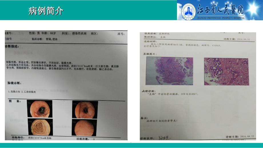 直肠癌MDTppt课件_第4页