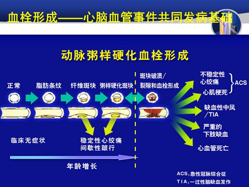 {企业管理诊断}冠心病分层诊断与处理共识_第4页