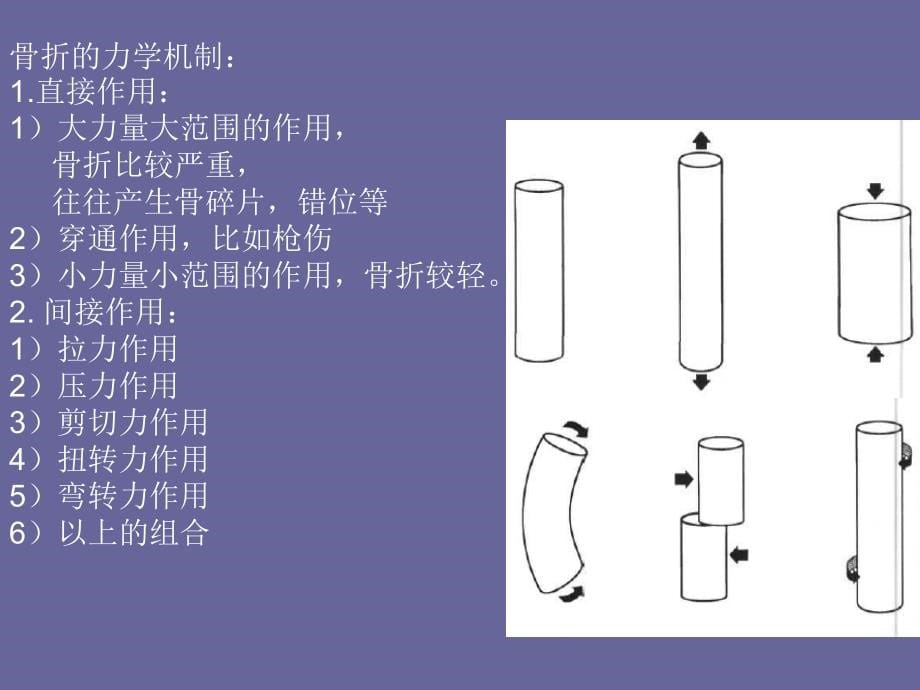 不寻常骨折的影像学分析知识课件_第5页