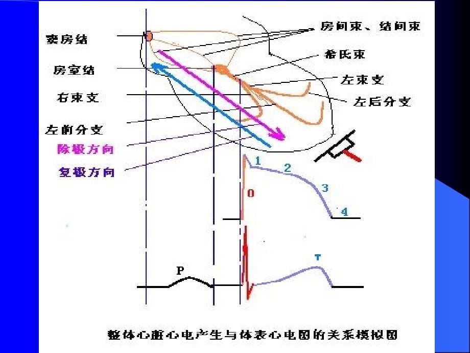 临床心电图基础课件_第5页