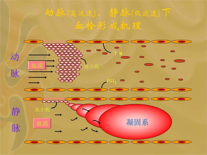 缺血性卒中的抗血小板治疗培训讲学_第4页