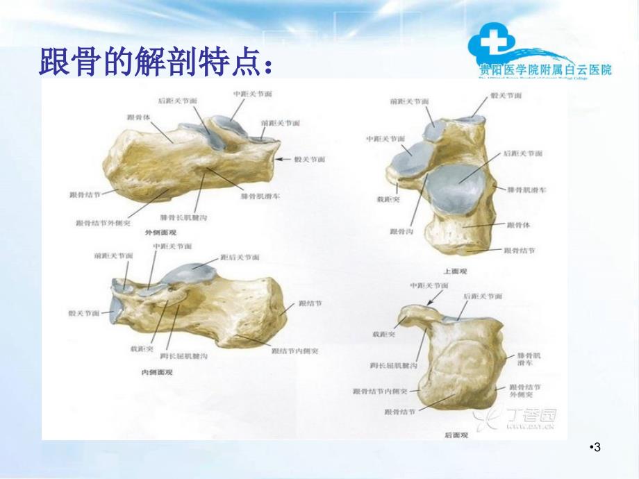 跟骨骨折（课堂PPT）_第3页