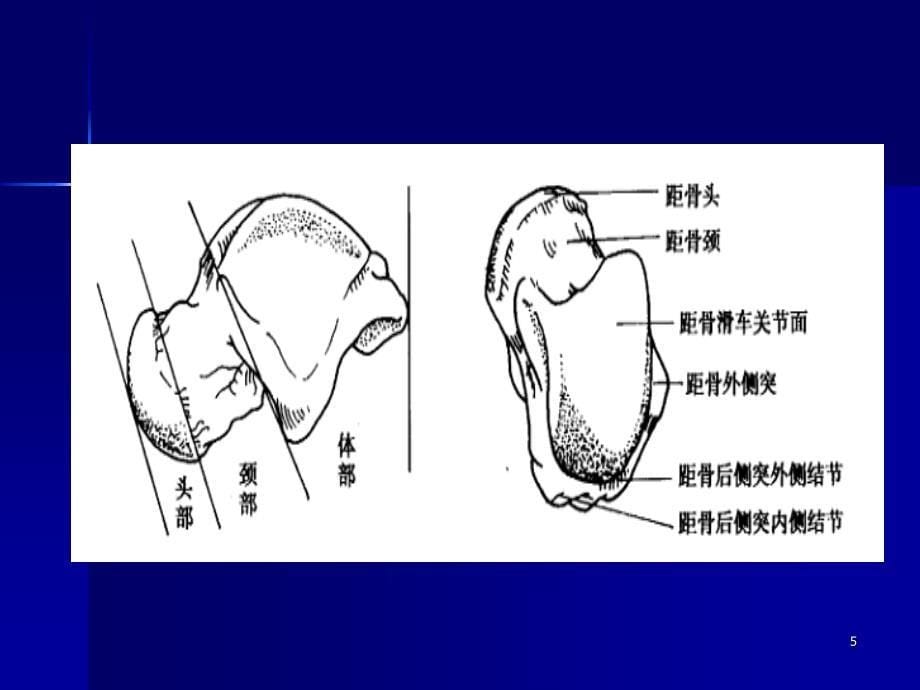 距骨骨折（课堂PPT）_第5页