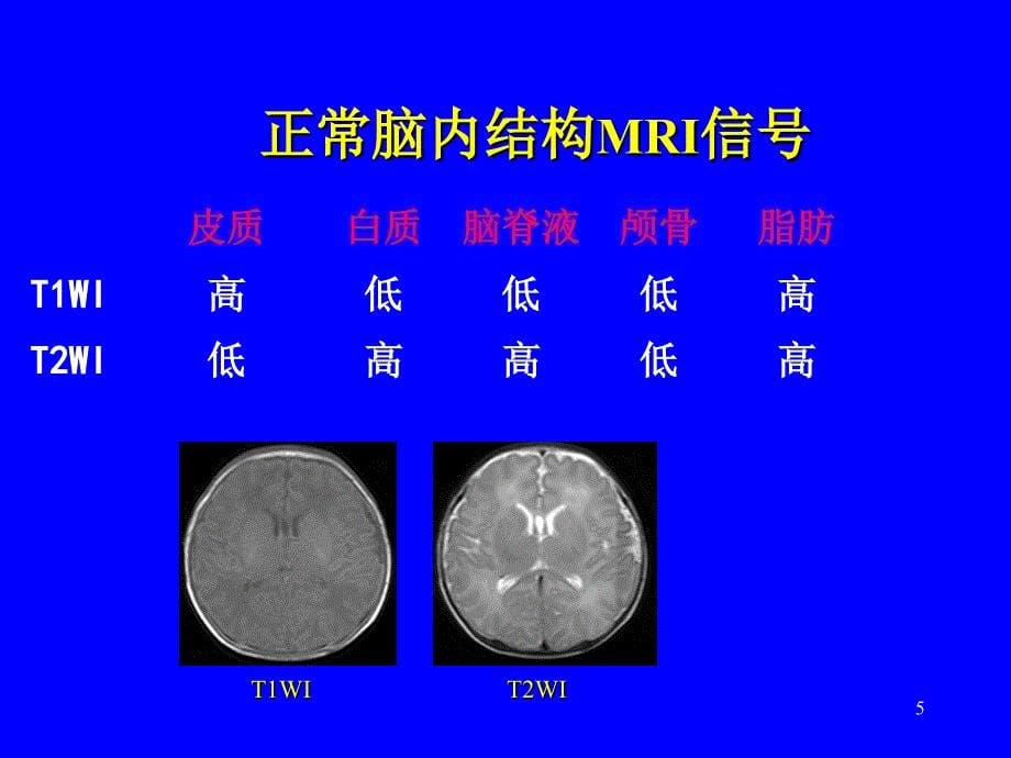 新生儿头部MRI（课堂PPT）_第5页