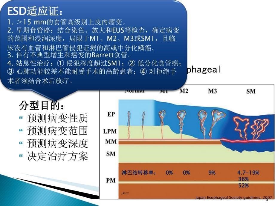 NBI+放大在食管早癌诊断中的应用进展演示PPT_第5页