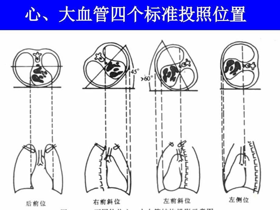 心与大血管系统影像诊断学（课堂PPT）_第5页