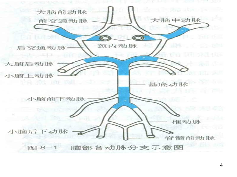 脑梗死MRI表现演示PPT_第4页