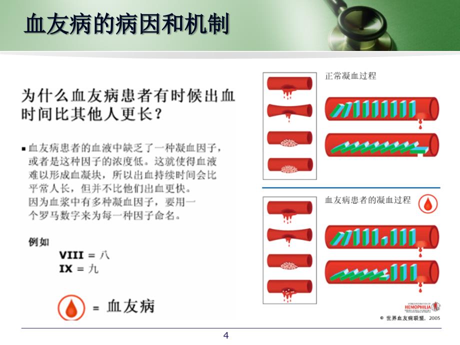 血友病 患者科普（课堂PPT）_第4页