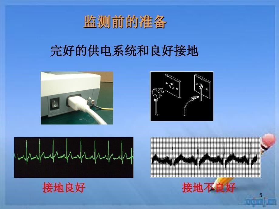 心电监护培训（课堂PPT）_第5页